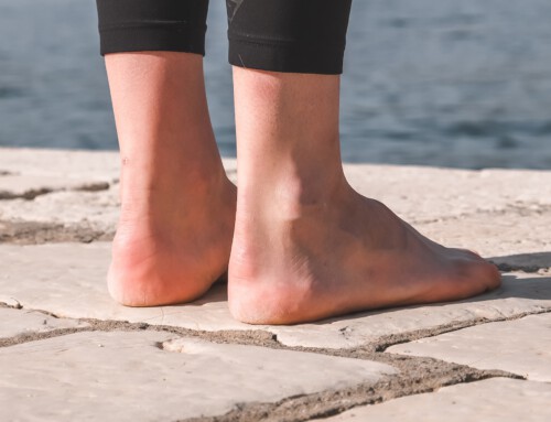 Knick-, Senk- & Spreizfuß – was ist das?